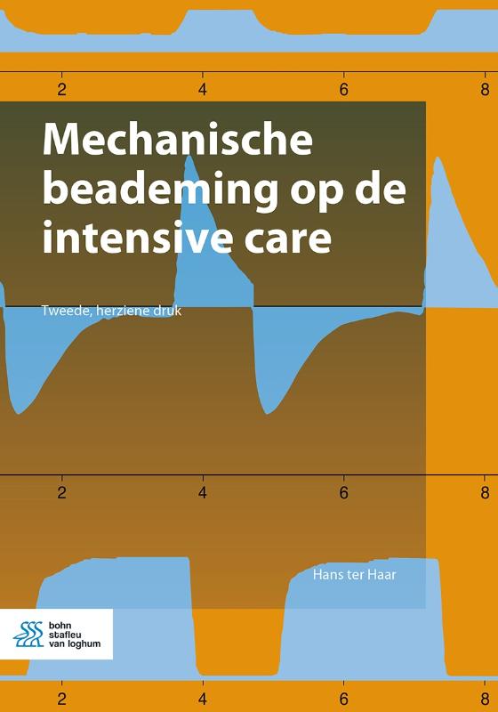 Mechanische beademing op de intensive care